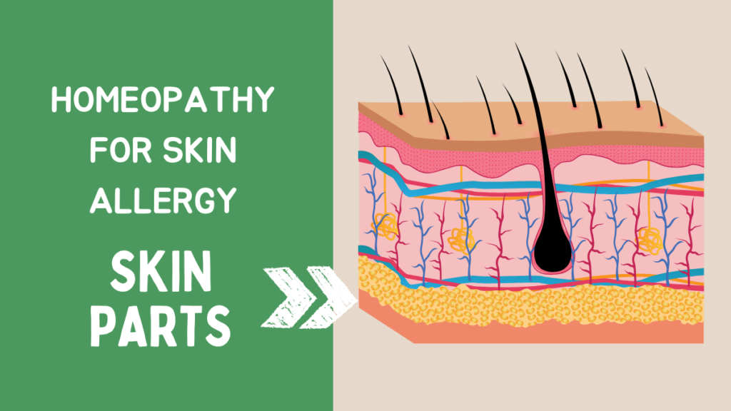 Homeopathy for Skin Allergy
