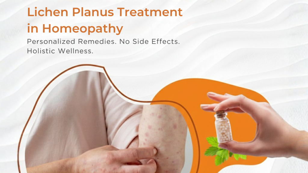 Lichen Planus Treatment in Homeopathy