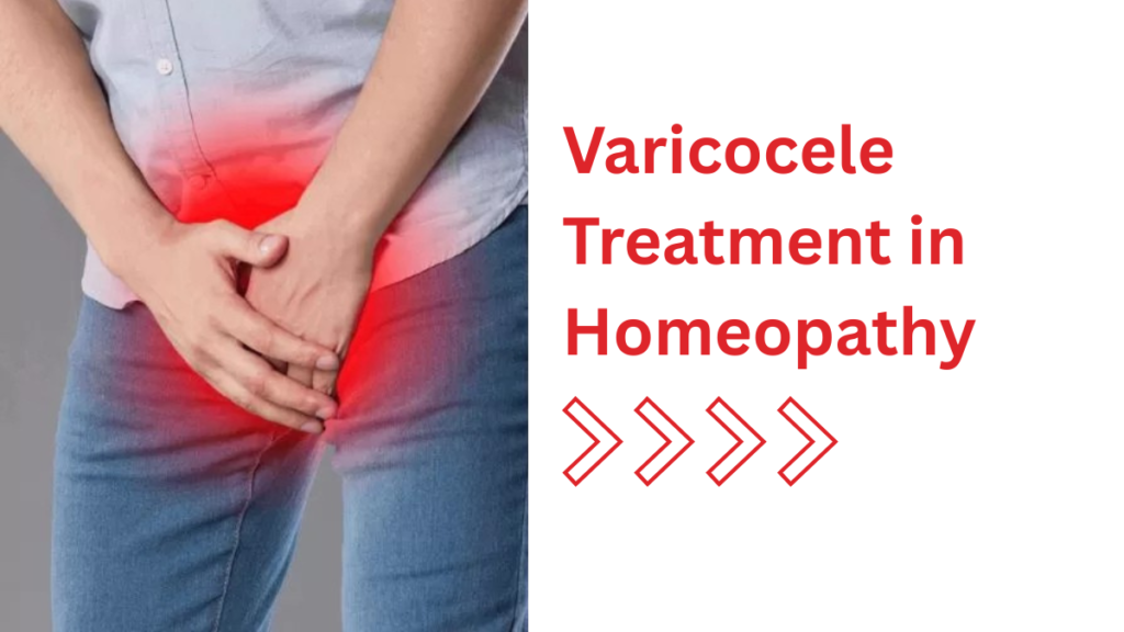 Varicocele Treatment in Homeopathy
